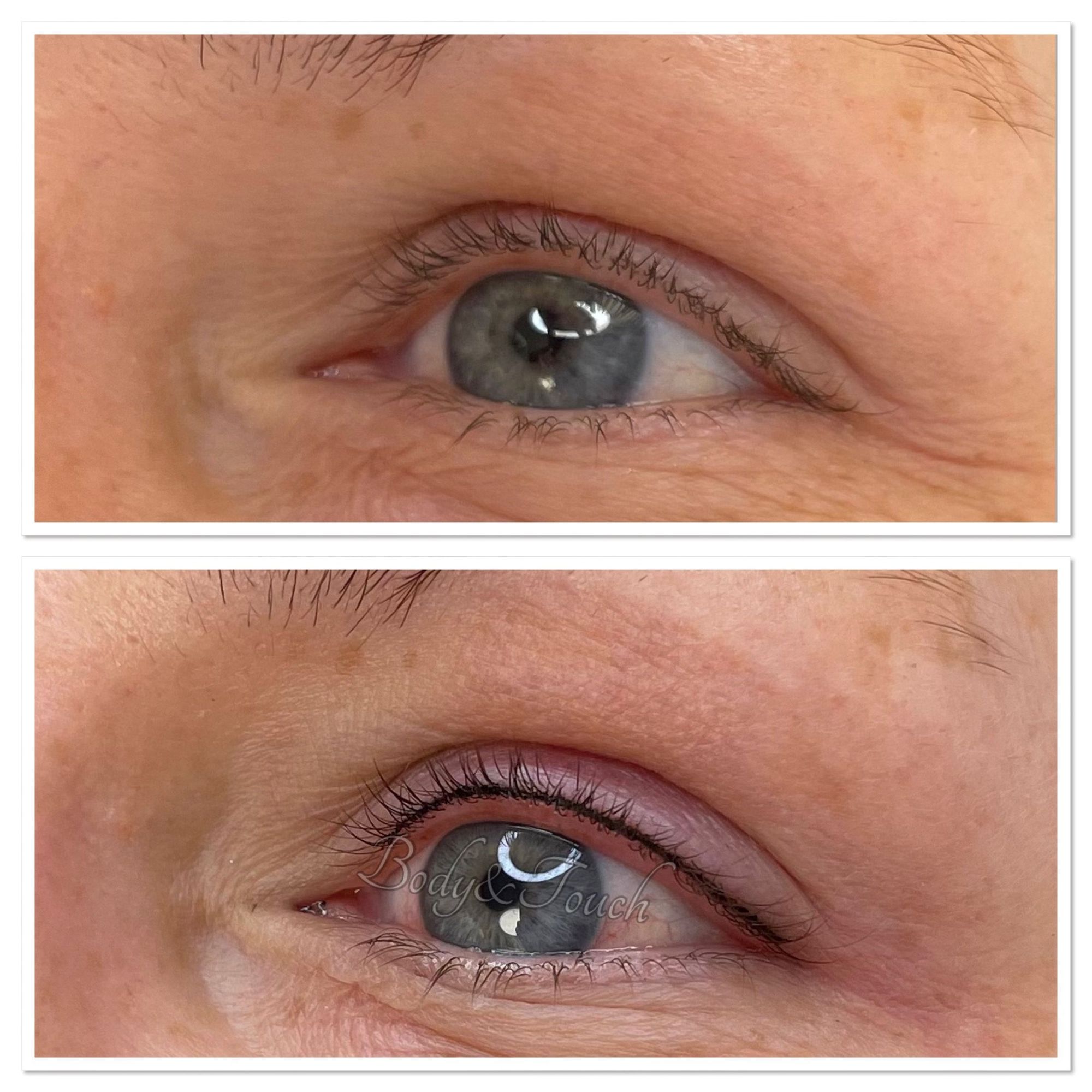 Wimpernkranzverdichtung Beispiel 4